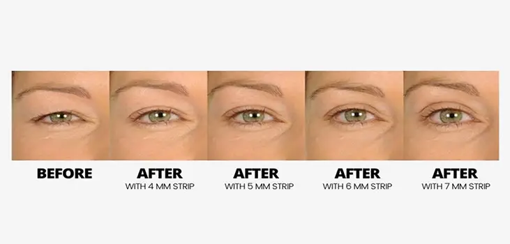 before and after using Contours RX